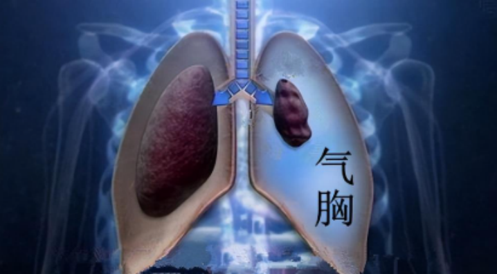 bfc736530beb620d8f9fc203ce9795b0.png bfc736530beb620d8f9fc203ce9795b0.png